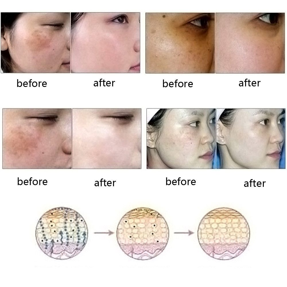 "Dredge Meridian Essence Oil
